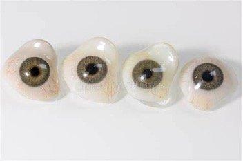 Protesi Oculari